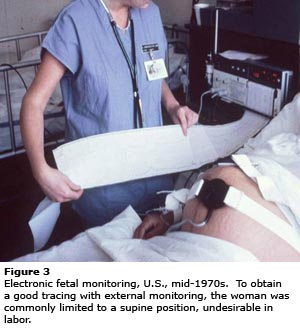 Electronic fetal heart monitoring essay